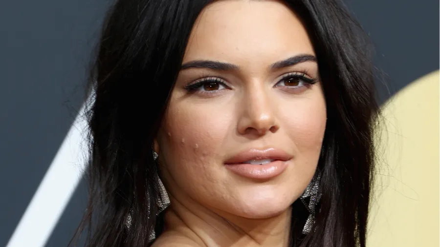 KENDALL-JENNER-IMPERFECCIONES
