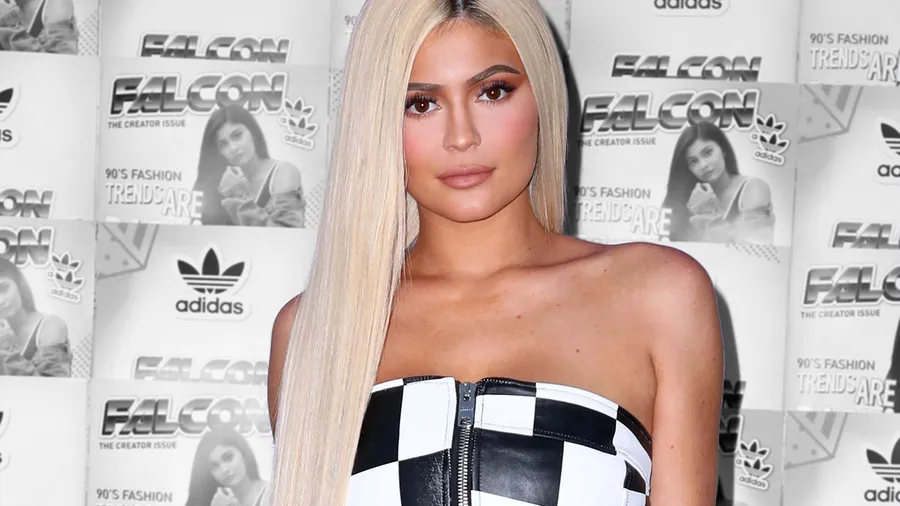 Kylie-jenner-Lip-Filler-2