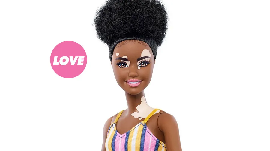 barbie-vitiligo-inclusive-collection