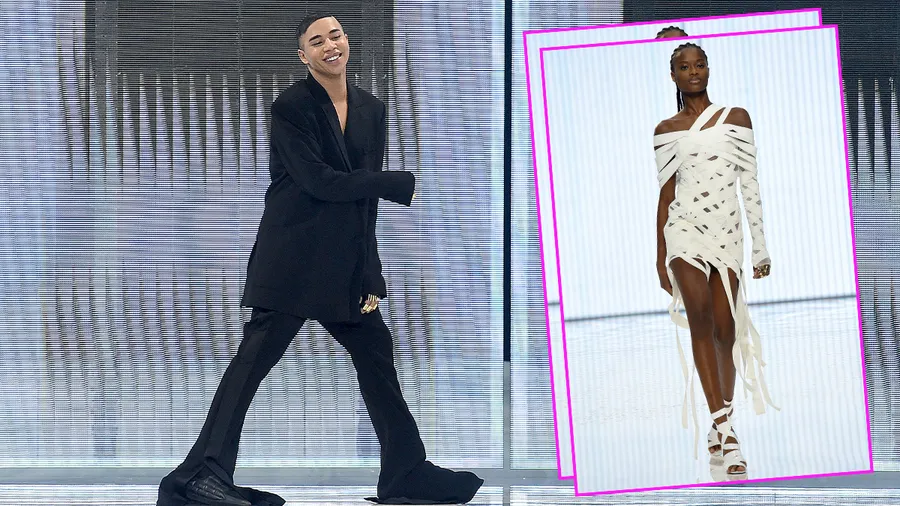 Olivier rousteing balmain quemaduras chimenea