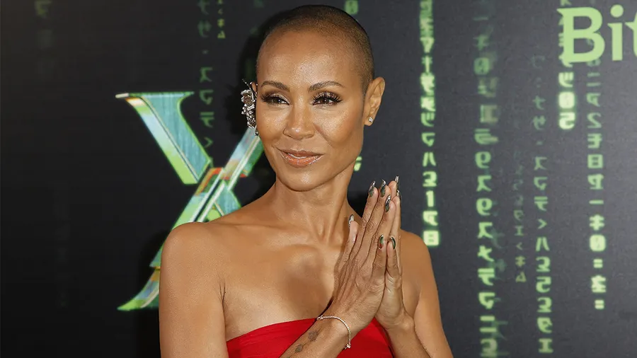 jada pinkett smith calvicie alopecia