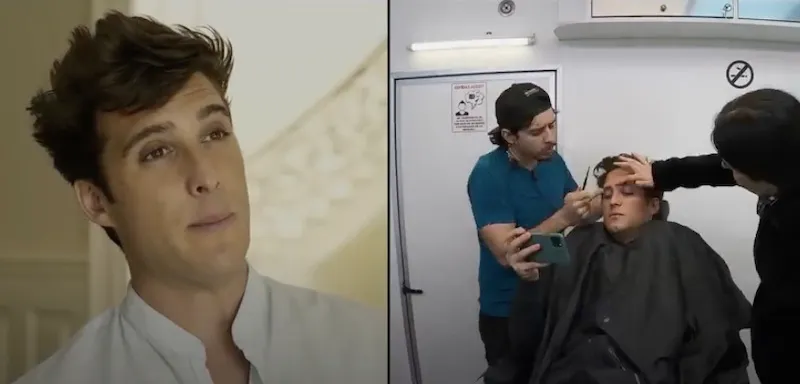 luis-miguel-prosteticos.jpg