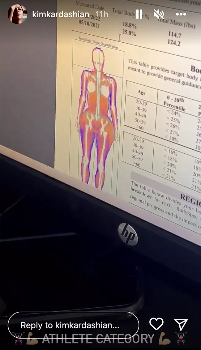 kim-kardashian-checks-bone-density-080422-1-1a1fbc67f89d46f98d4f9221a48a2526.jpg