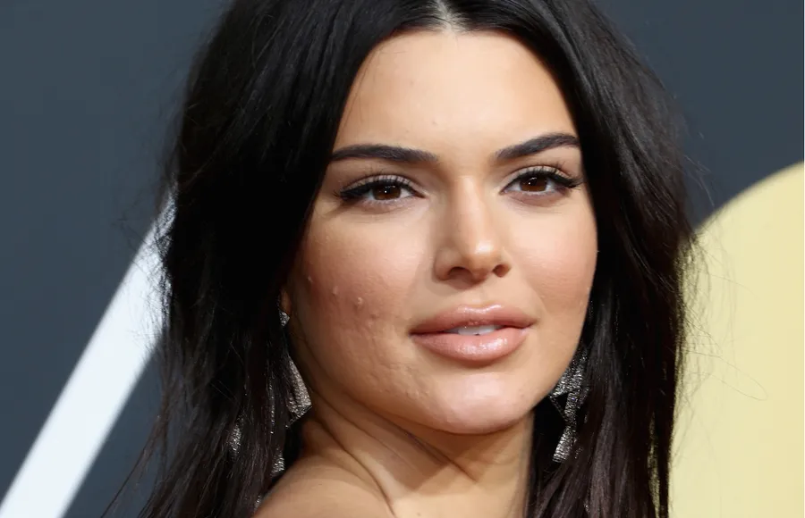 KENDALL-JENNER-IMPERFECCIONES