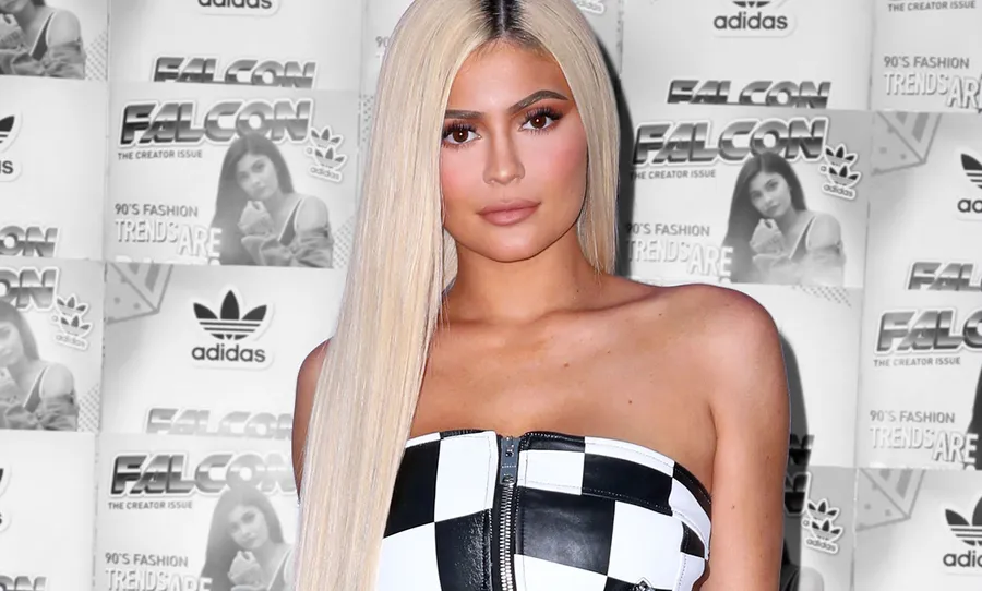 Kylie-jenner-Lip-Filler-2