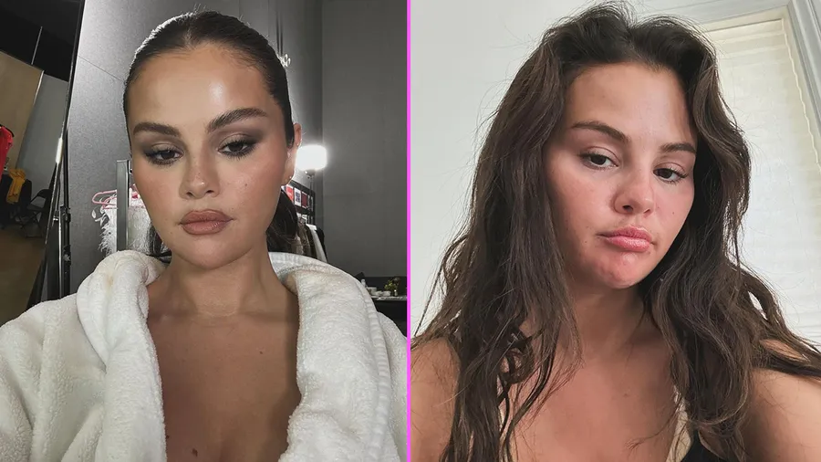 Selena Gomez tratamientos estéticos