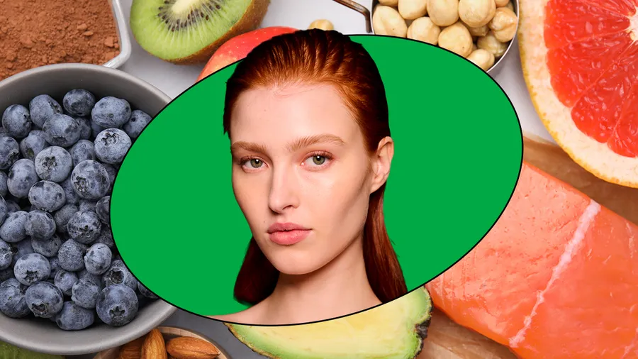 Estos son los alimentos que debes incluir en tu dieta para prevenir el acné