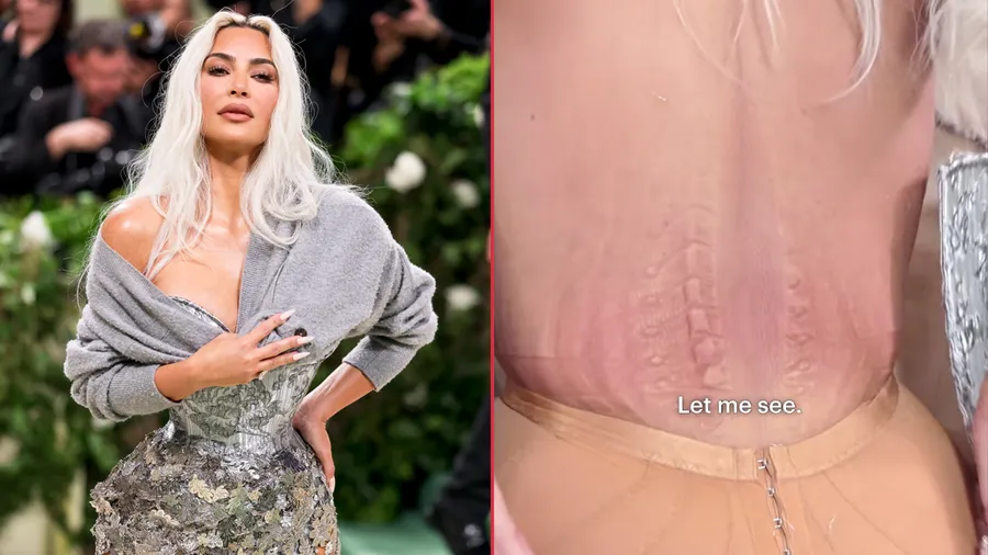 destacada-kim-kardashian-daño-corset.jpg