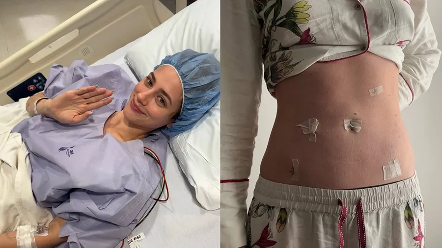 lili-reinhart-endometriosis