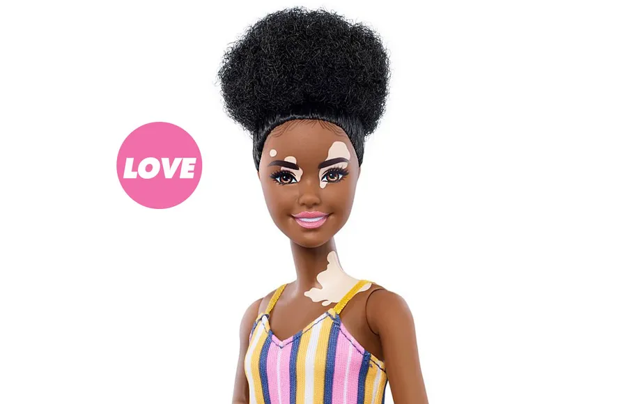 barbie-vitiligo-inclusive-collection