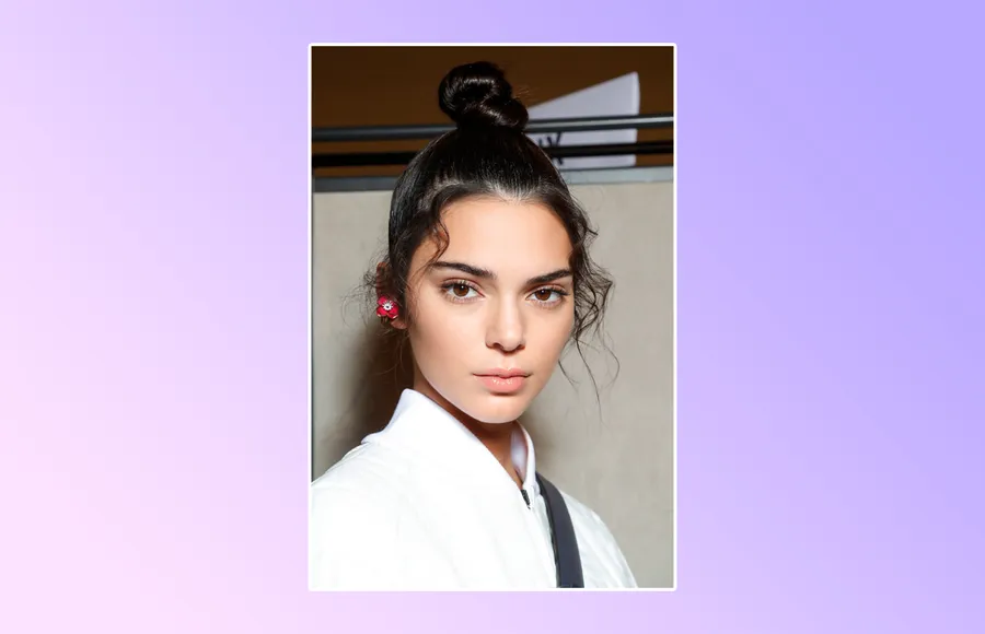 FENDIs19-FILLERS-LABIOS-LIP FILLERS-PIEL-COMPLEXION.jpg