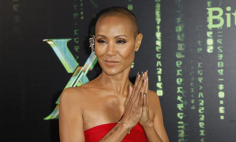 jada pinkett smith calvicie alopecia