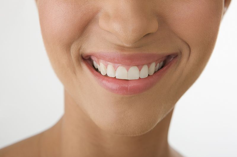 Smile Technician