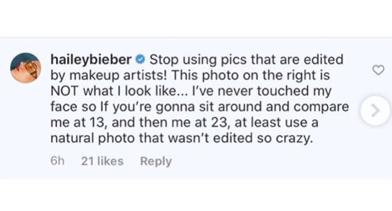 hailey-bieber-cirujano-plastico