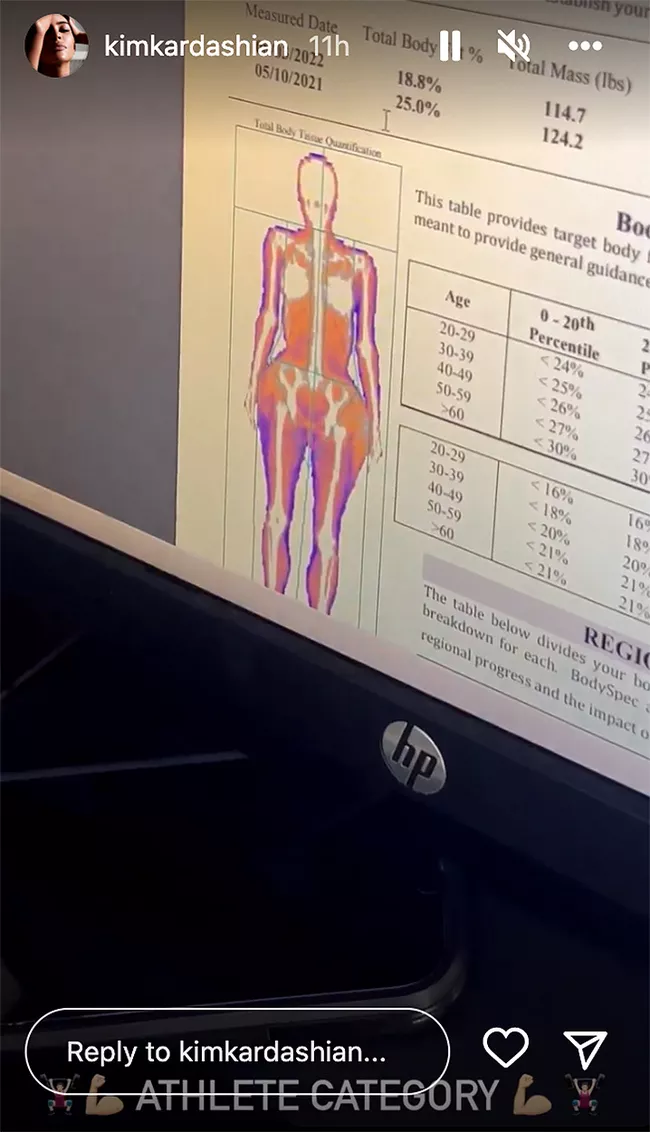 kim-kardashian-checks-bone-density-080422-1-1a1fbc67f89d46f98d4f9221a48a2526.jpg