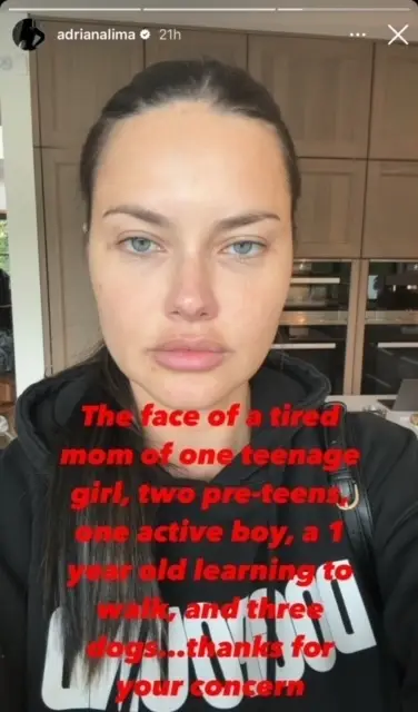 Adriana Lima responde a quienes se preocuparon por su apariencia