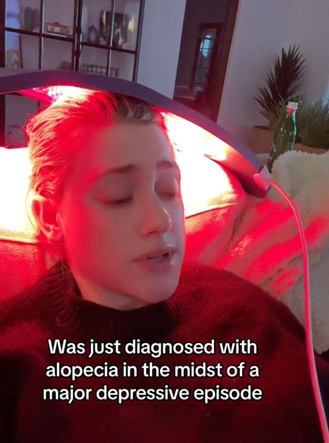 Lili Reinhart recibe tratamiento contra la alopecia.